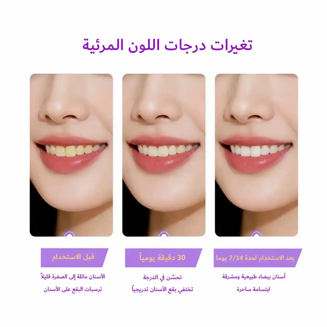 شرائط HisSmile لـ تبييض الأسنان (١٤ زوجاً) — بتركيبة PAP الآمنة وبدون تحسس!